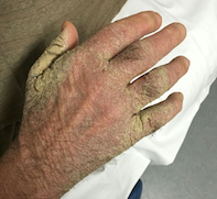 Fig 1a. Fig 1a.